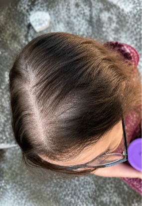 Antes, Transformação Cronocaps Hair